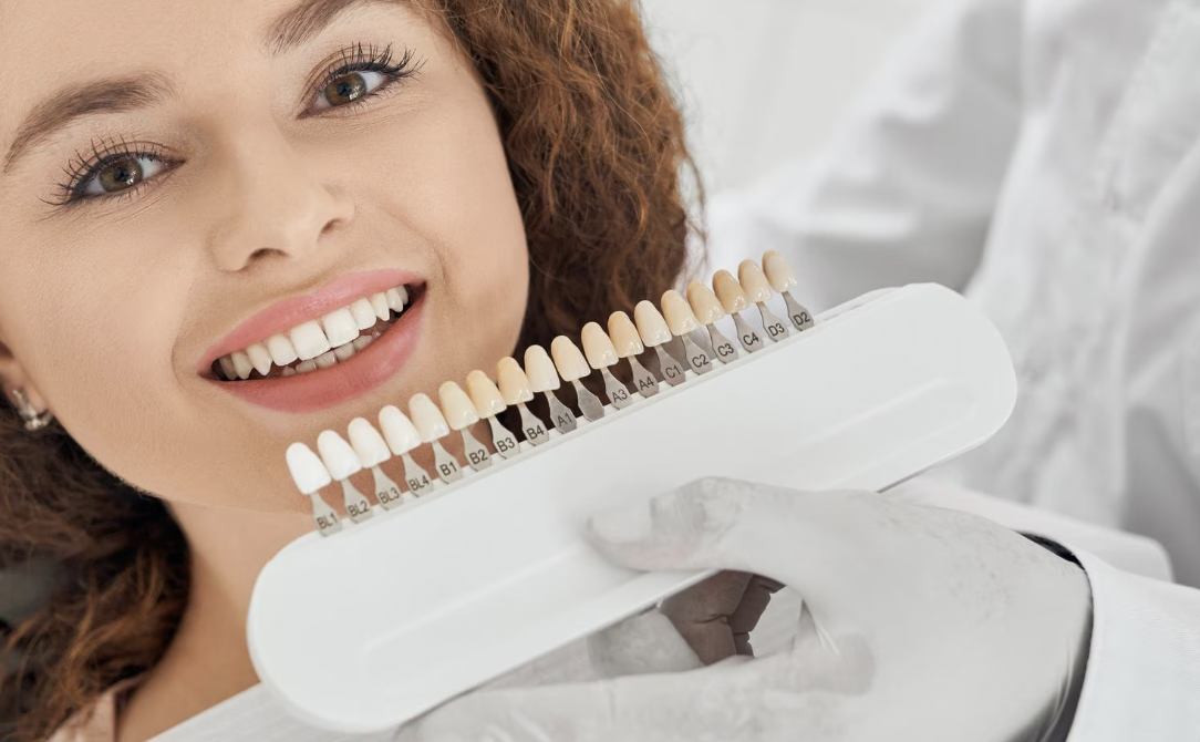 Smile Makeover Choices Explained Whitening, Bonding, or Veneers for a Brighter You